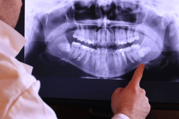 Best Emergency Treatment for Jaw Pain or Injury in Harrisburg, OR